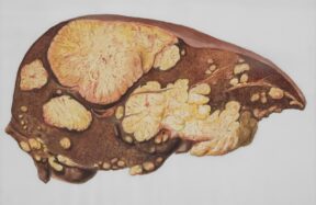 a drawing of a human brain with multiple sections