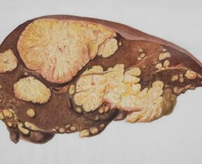 a drawing of a human brain with multiple sections