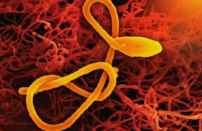 a close up of a cell phone with a yellow cord
